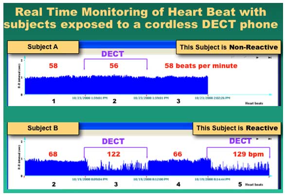 heart-beat-monitoring-chart-EndAllDisease.jpg